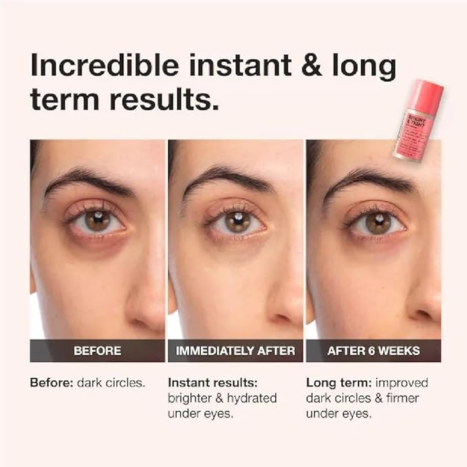 NAPH iNNBEAUTY PROJECT Bright & Tight Dark Circle Firming Eye Cream with Vitamin C & Peptides (0.5 oz / 15 mL) + Bonus Acne Patch (36 Pieces)