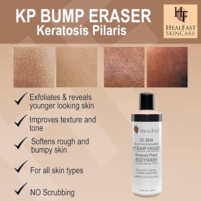 HealFast KP Bump Eraser Bodywash – Soften, Exfoliate, Nourish Rough and Bumpy Skin with 3% BHA – Keratosis Pilaris - For All Types – No Scrubbing Required – Fragrance and Paraben Free