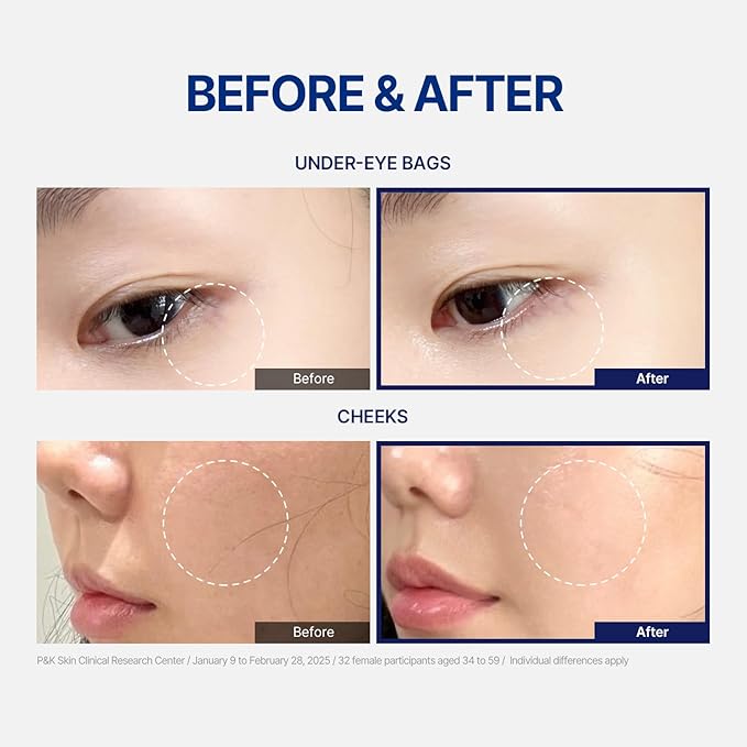 Zombie Line Reset Serum, Targeted Spot Serum with Peptides & Liposome, Korean Precision Smoothing Serum for Fine Lines & Texture, 15ml