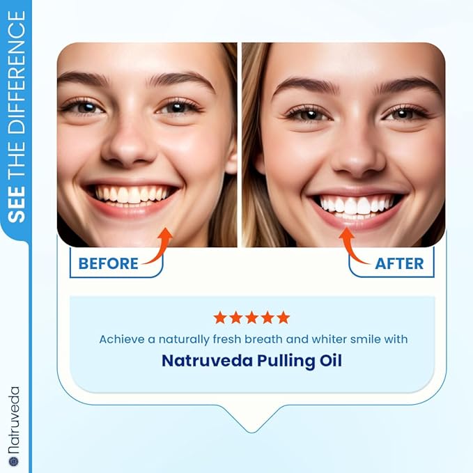 Natruveda Coconut Oil Pulling Mouthwash – Natural Whitening Ayurvedic Rinse | Fresh Mint Blend | Coconut Oil Pulling for Teeth & Gums | Whyte Oil Pulling | Aceite de Coco para Los Dientes -10 oz
