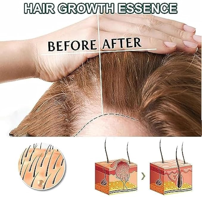 Shougagro Japanese Ginger Ginseng Hair Growth Serum Spray, HyunGang Korea Hair Regrowth Spray for Men Women (2 Pcs)