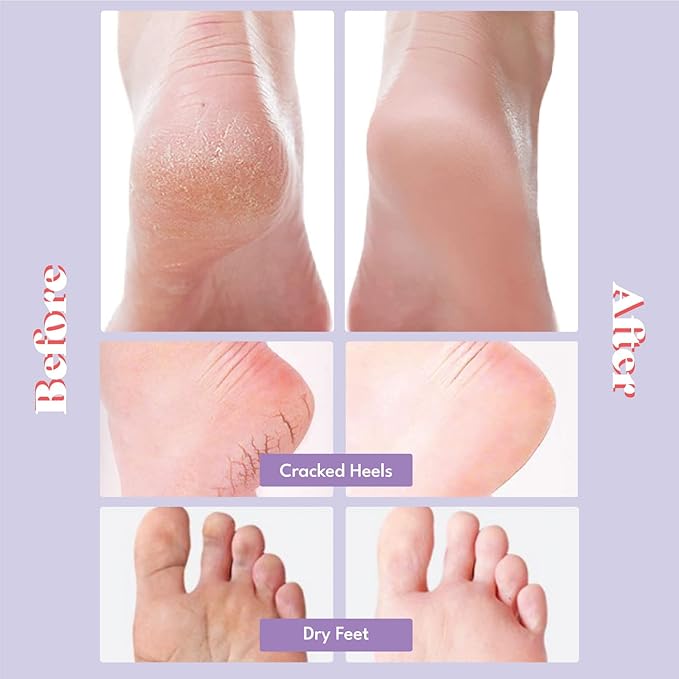 Toi:L Extra Silky Foot Mask 5 Pairs, Post-Peeling Foot Care Treatment, Moisturizing Socks with Guerande Salt & Sweet Almond Oil for Dry Feet, Cracked Heels, and Callus, Stocking Stuffer