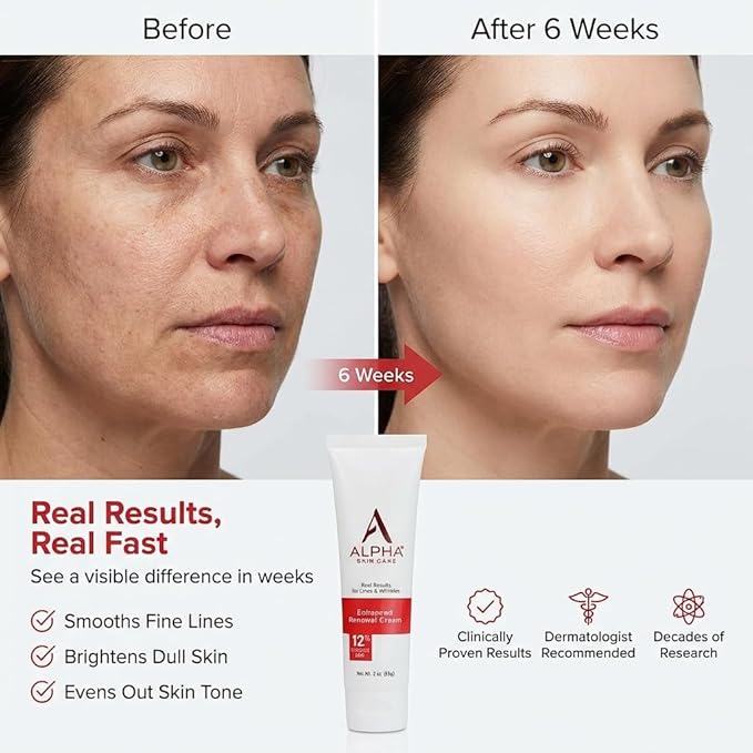 Alpha Skin Care Enhanced Renewal Cream, Anti-Aging Formula, 12% Glycolic AHA, Reduces Lines & Wrinkles, Normal to Dry Skin, 2 Oz, Pack of 1