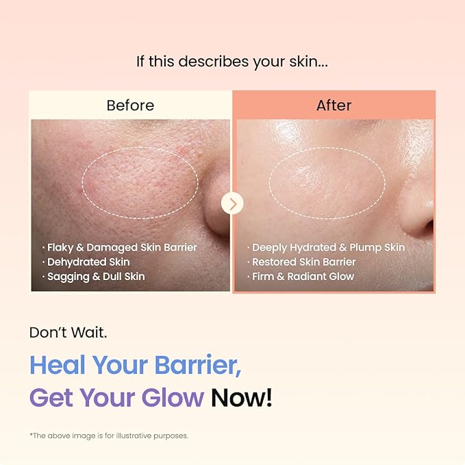 BIODANCE Barrier Rescue Duo: Caviar PDRN & Ceramide Panthenol Real Deep Overnight Gel Mask for Hydrating Plumping for Glass Skin, Korean Skin Care, Valentines Day Gifts for Her, Skin Care Set