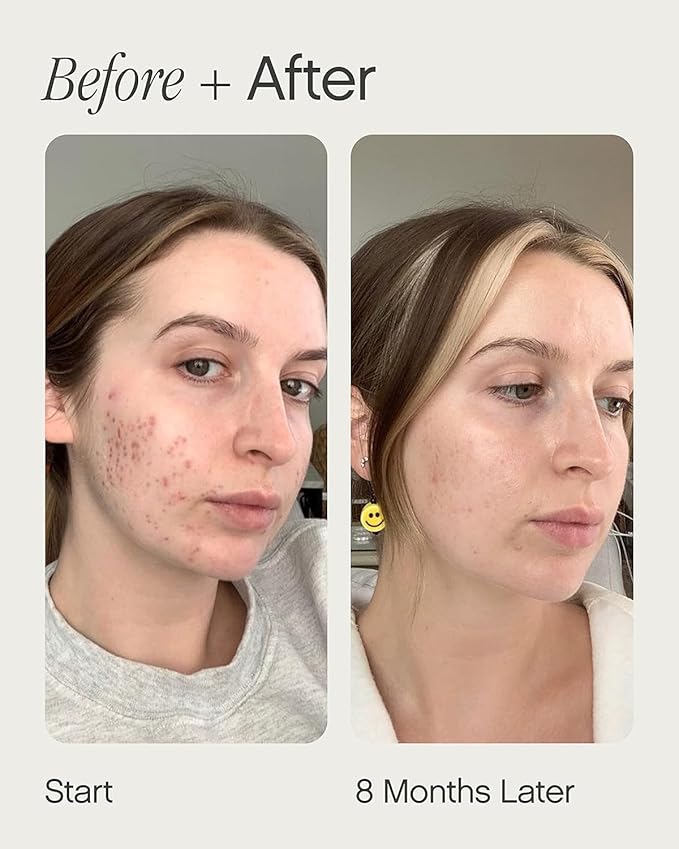 Topicals Faded Brightening and Clearing Serum | Reduces Discoloration, Post-Blemish Marks, Scars and Spots | Contains Kojic Acid and Niacinamide | Dermatologist-tested, Vegan, Cruelty-Free (0.5 Fl Oz)