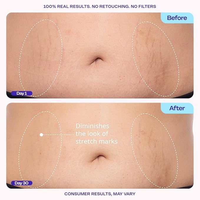 goPure Firming Belly Cream - Body Firming Moisturizer for Visible Cellulite & Stretch Mark Reduction, 4.25oz