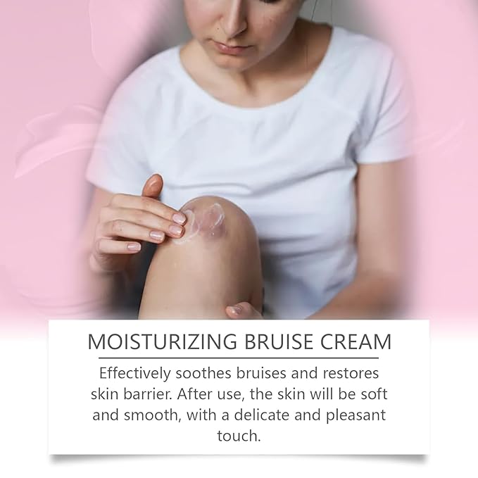 Bruise Cream with Vitamin K– Moisturizing & Firming Formula for Arms, Legs & Hands – Restores Fragile Skin with Anti-Wrinkle Benefits – 4.23 oz