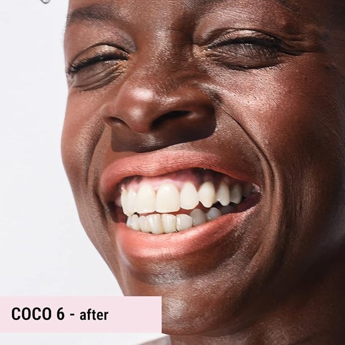The Good Mineral Loves-You-Back 3in1 Mineral Powder Foundation (COCO 6) | Designed for acne-prone, sensitive skin | Lightweight Coverage for hyperpigmentation + marks | Concealer, Foundation + Powder