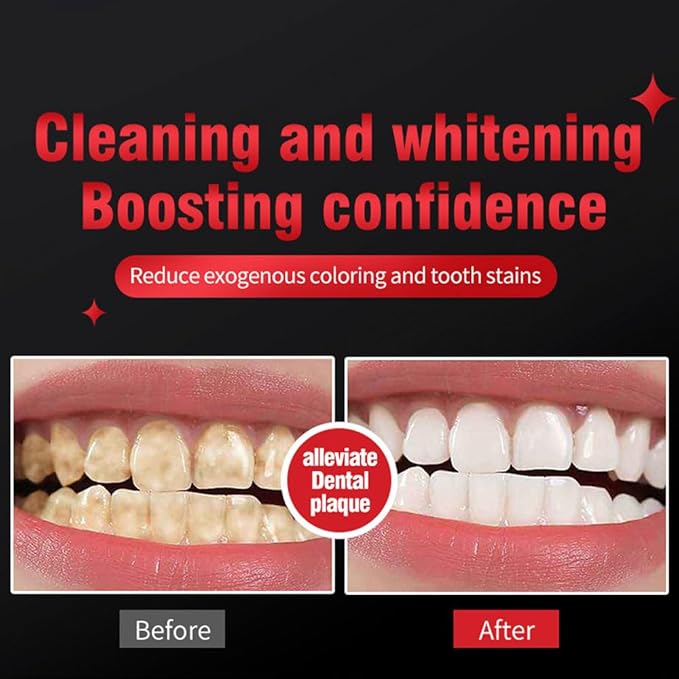 SP-6 Probiotic Whitening Toothpaste – Advanced Formula with 6 Probiotics for Teeth Whitening & Gum Health, Fluoride-Free, Enamel-Safe, Fresh Mint Flavor, 4.9oz (2 Pack)