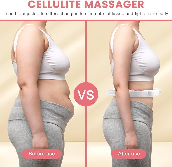 Cellulite Remover Massager – Detachable Handles, Smooth Glide for Legs & Arms, Skin Tightening