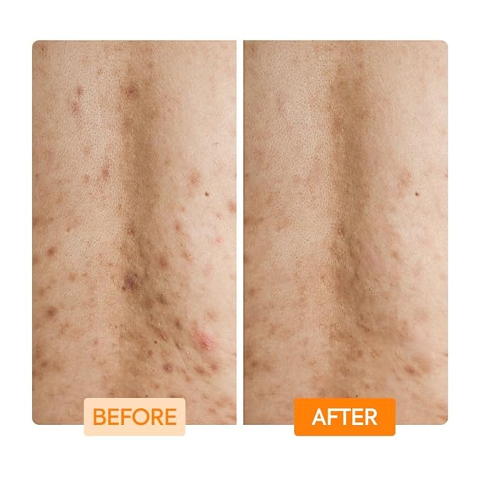 MAKARI IYKYK Gentle Exfoliating Body Wash 2 Pack | Glycolic & Lactic Acid Cleanser with Niacinamide | Smooths Dry Skin for Radiant-Looking Results | Vegan & Fragrance-Free