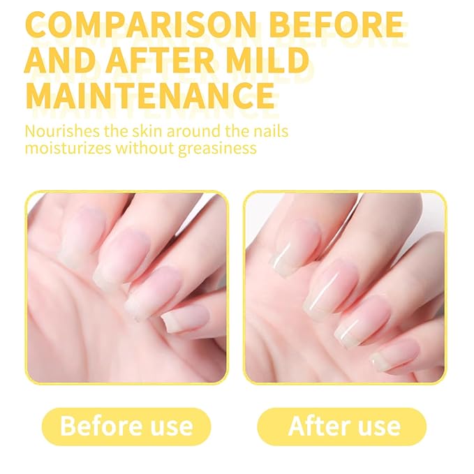 Cuticle Oil with Cherry Fragrance - 15ml Nail & Cuticle Care| Vitamin E Enriched for Dry, Cracked Cuticles | Moisturizing, Fast Absorbing, Non-Greasy