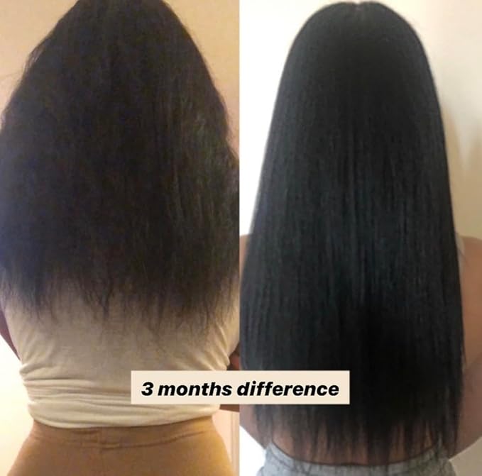 Hair Growth Oil with Rare Batana & Ayurvedic Herbs - Extra Strength Natural Treatment for Thinning Hair Loss, Edges, Scalp Health - Strengthens & Thickens All Hair Types - 30+ Botanicals - 2oz