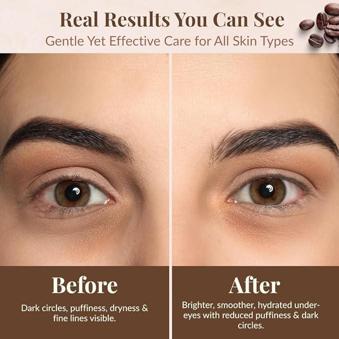 Lady May Coffee-Infused Tallow Eye Cream – Brighten, Firm & Revitalize Naturally