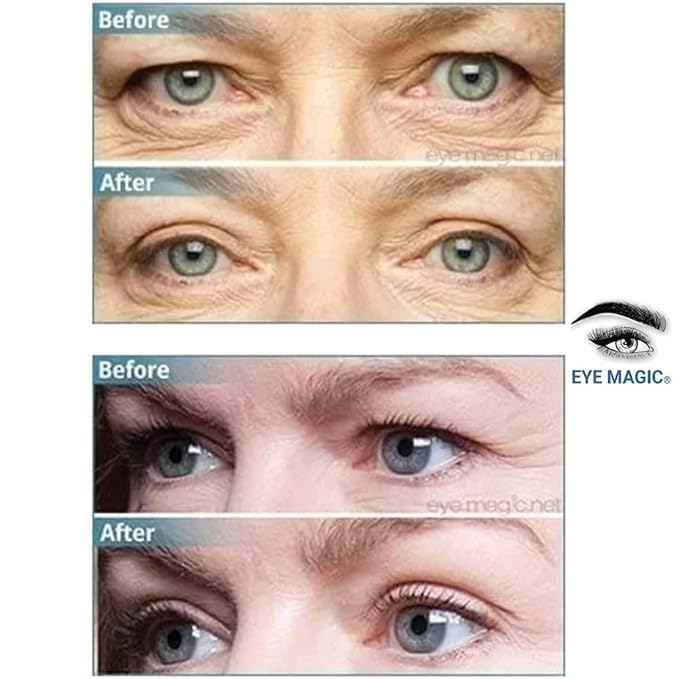 Eye Magic Premium Original Eye Lift Kit - Medium-Kit Size, 64 Count, Strips + Wax/Gel, Original Premium Kit, Made in USA