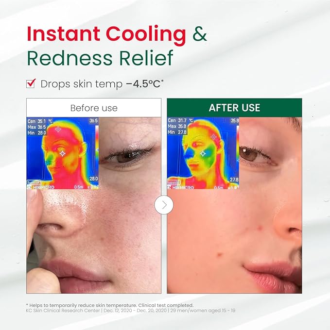 Dr. G R.E.D. Blemish Clear Hyal-Cica Soothing Serum - Korean Skincare - Long-Lasting, Hydrating Serum for All Skin Types - Cools Skin Temperature - Hyaluronic Acid & Centella Asiatica - 1.69 fl oz
