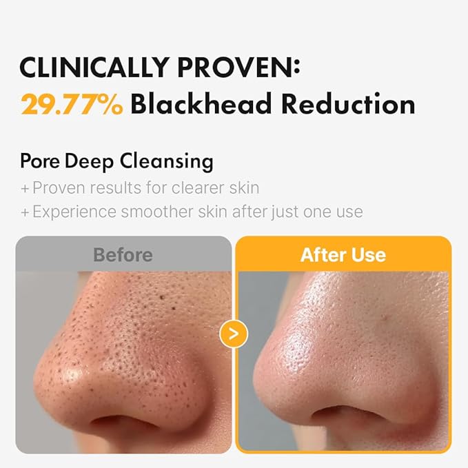 Hanskin PHA Pore Cleansing Oil - Korean Deep Pore Cleansing Makeup & Sebum Remover XL, Blackhead & Large Pores Cleanser for Sensitive Skin, Double Cleansing First Step, Plant-Based Care, 10.14oz