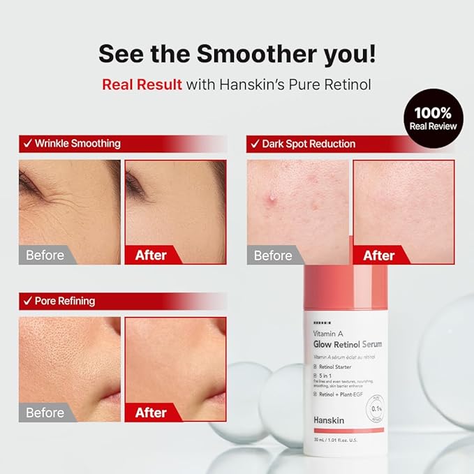 Hanskin 0.1% Pure Retinol Facial Serum for Face, Reduce Fine Lines & Wrinkles, Signs of Aging for Day & Night, Smoothing Firming Revitalizing, Animal Testing Free, Korean Skincare, 30ml/1.01 FL Oz