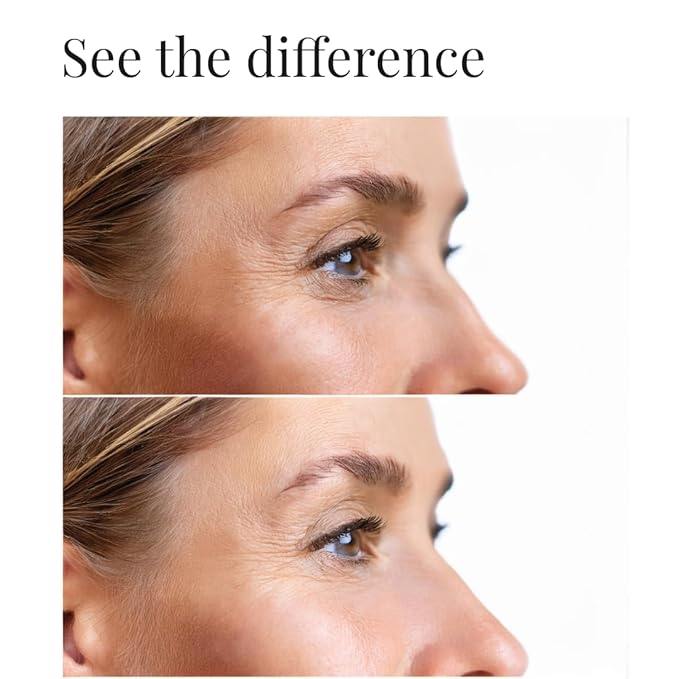 Dark Circles Under Eye Treatment | Eye Cream Anti Aging for Dark Circles, Bags Under the Eyes and Reducing Wrinkles