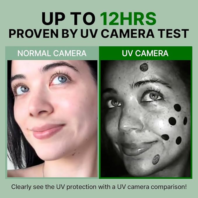 FRANZ Dark Spot Pimple Patche for Acne Marks & Post Acne Spot, Invisible Thin Pimple Spot Treatment, Makeup-Friendly with UV Protection for Daytime Acne Care - 72 Patches