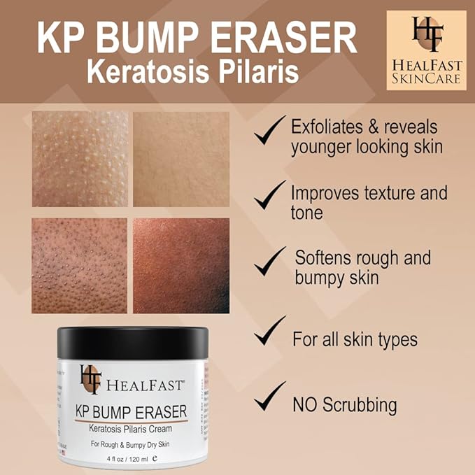 Healfast KP Bump Eraser Cream (4 Oz) and Bodywash (8 Oz) Set – Soften, Exfoliate, Nourish Rough and Bumpy Skin – Keratosis Pilaris - For All Types