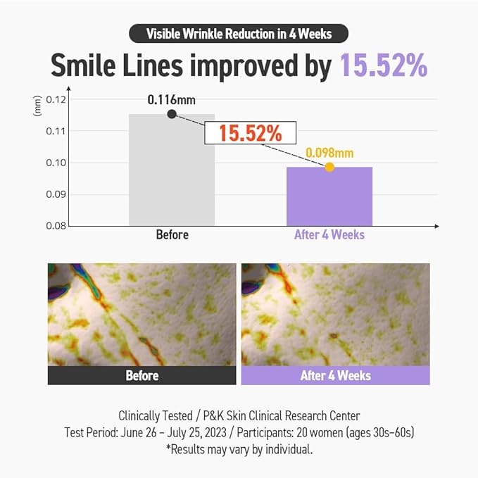 Wrinkle Master Patch – Smile Line Wrinkle Patches for Laugh Lines | Korean Skincare (36 patches)