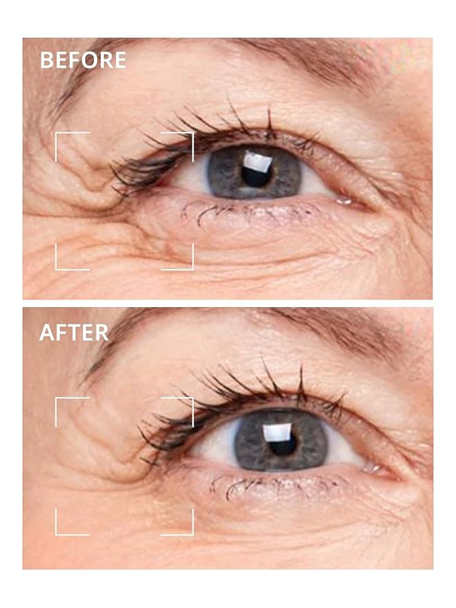 depology Deepcare+ Serum-Infused Micro Dart Patche | 12 Pairs Eye Mask | Under Eye Patches for Wrinkles | Hydrating Eye Mask with Peptides