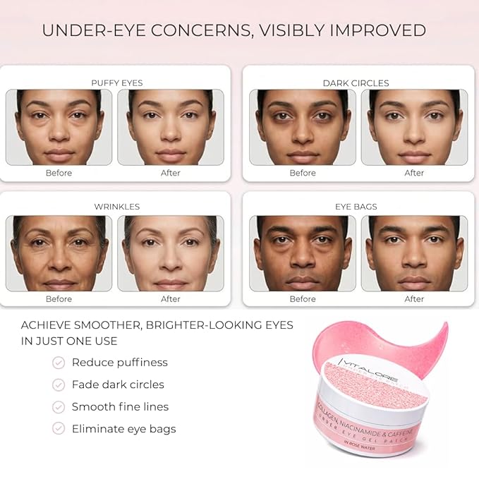 Under Eye Patches for Dark Circles & Puffiness – Collagen, Caffeine & Niacinamide Eye Masks – Hydrating Depuffing Anti-Aging Under Eye Patches for Bags & Fine Lines- 60 ct.