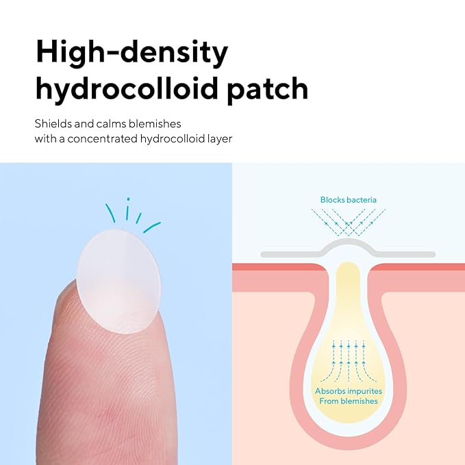 caraseoul Pimple Patches, 2 Size Hydrocolloid Acne Patch for Zits and Blemishes, Bakuchiol & Aloe Vera, Korean Skin Care, Easy to Use – Dermatology Tested