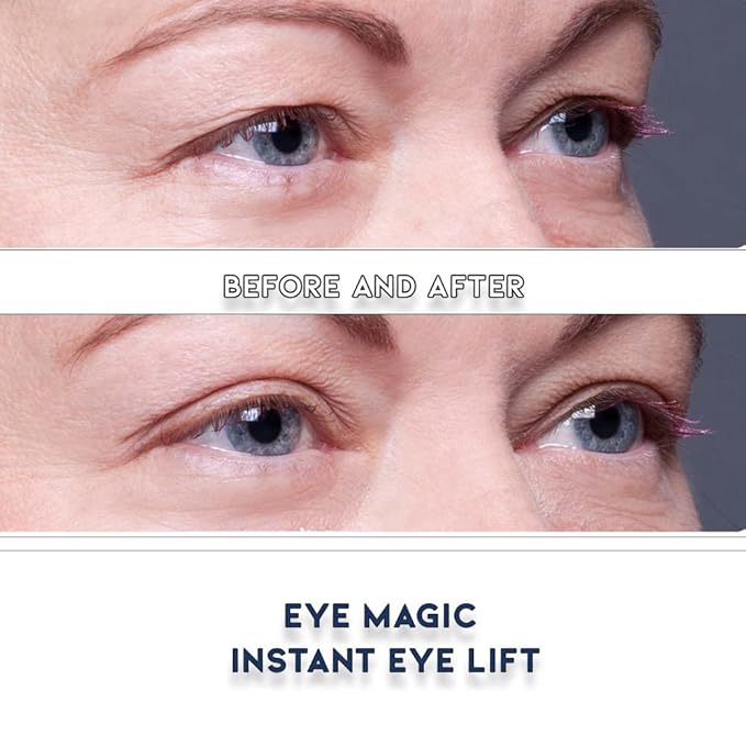 Eye Magic Premium Eye Lift Strips - Medium Size, 80 Count Refill Pack, Strips Only (no Gel), for Droopy, Sagging, or Hooded Eyelids, Hypoallergenic, Strong Hold, Made in USA