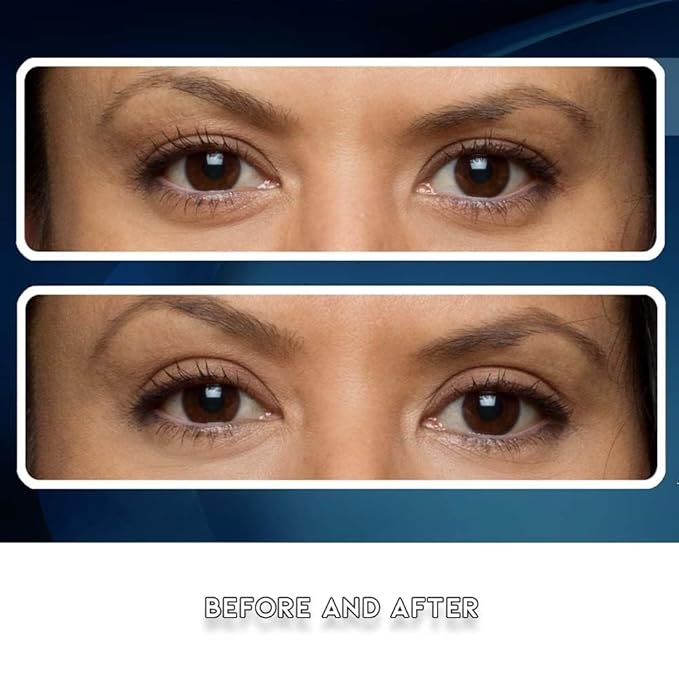 Eye Magic Premium Eye Lift Strips - Small Size, 88 Count Pack, Strips Only (no gel), for Smaller Eyelid Sizes, Instant Non-Surgical Lift, Made in USA