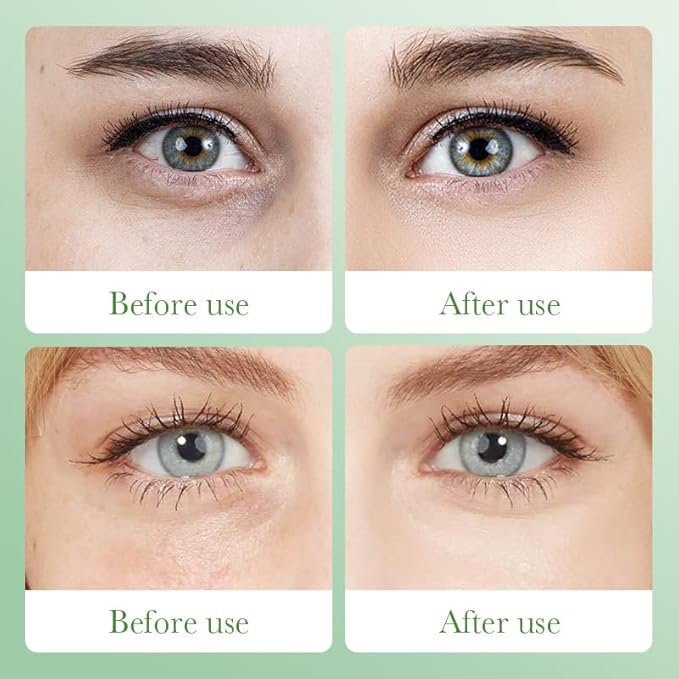 AKARY Aloe Vera Under Eye Patches for Dark Circles, Puffy Eyes & Wrinkles, 98% Aloe Essence & Collagen Infused Eye Masks, Smoothing, Hydrating, Firming Care, Fine Lines, Eye Bags Reduction (60 Pcs)