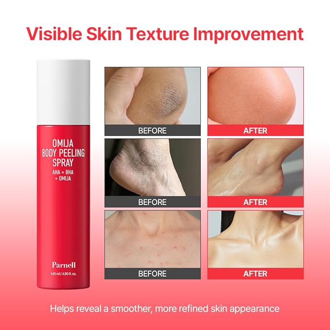 PARNELL AHA Omija Ceramic Body Peeling Spray – AHA BHA PHA Body Exfoliant for Keratosis Pilaris, Strawberry Legs, Dark Spots & Dead Skin Remover – Chemical Exfoliant, Rough Skin 4.60 fl.oz