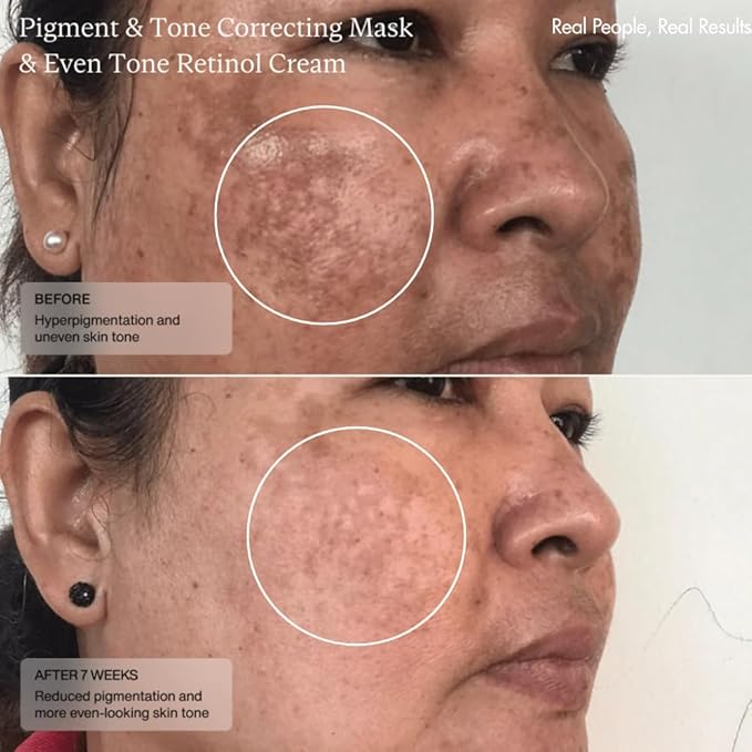 Senté Cysteamine HSA Pigment and Tone Corrector- Hyperpigmentation Treatment For Reducing The Appearance of Dark Spots And Improving Skin Tone - 1.7 Fl Oz