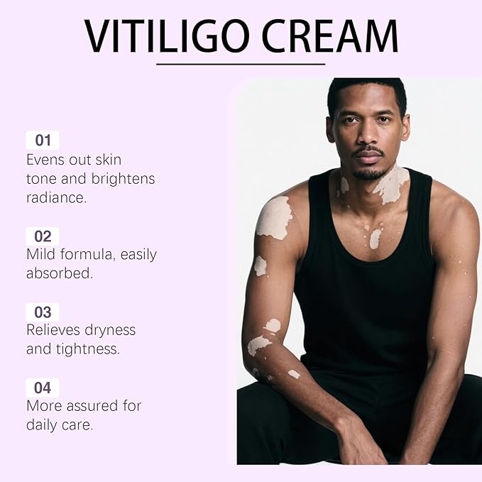 Vitiligo Cream, Vitiligo Treatment Cream， Reduce White Spots，Easy to Use