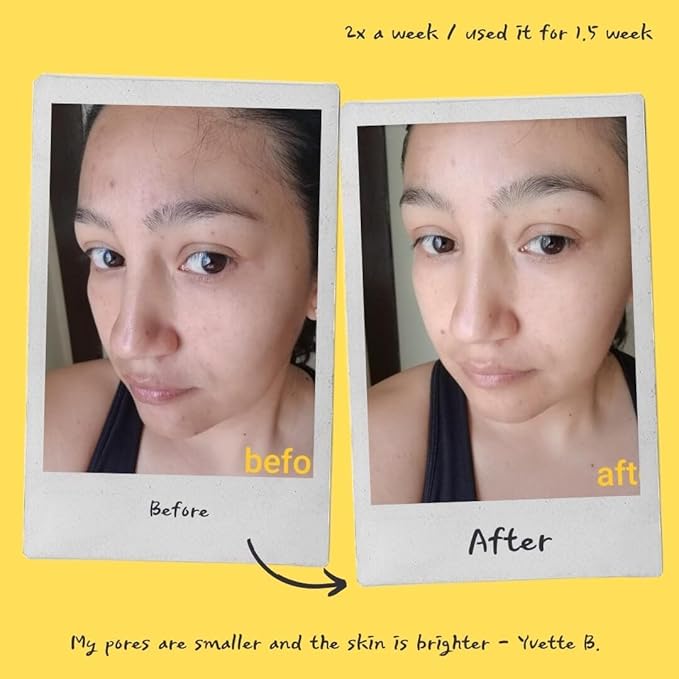Exfoliating Mask (Orange)
