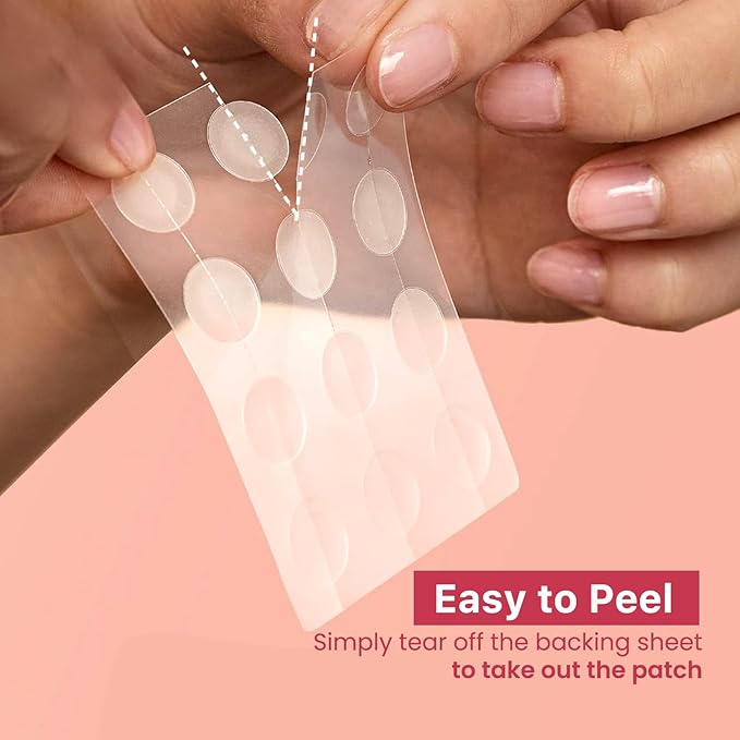 ROSELYNBOUTIQUE Pimple Patches for Face (60Ct - 4 Sizes 8,10,12,14mm) - Hydrocolloid Acne Spot Patches Blemishes Pore Strips - Vegan Facial Korean Skin Care Products Cruelty-Free (60 Dots)