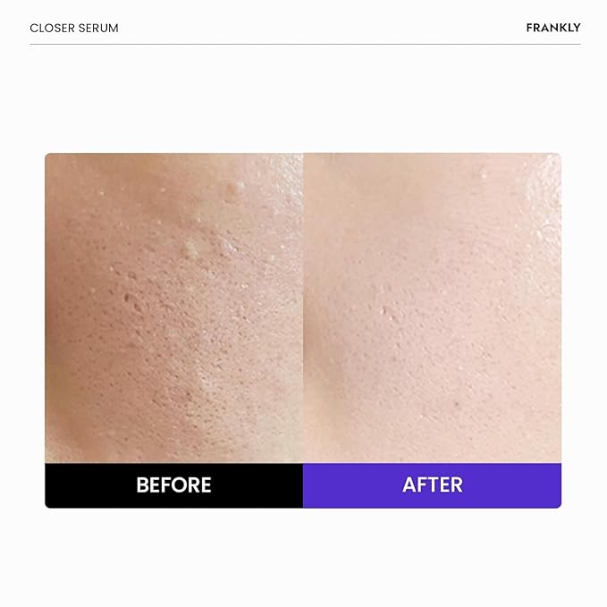 FRANKLY Closer Serum Mega Jumbo | Pore Minimizer Serum | 9 Peptides, Vegan Collagen, Adenosine, PHA | Korean Pore Minimizer for Glass Skin, Anti-Aging, Hydration, Elasticity | 3.38 fl oz
