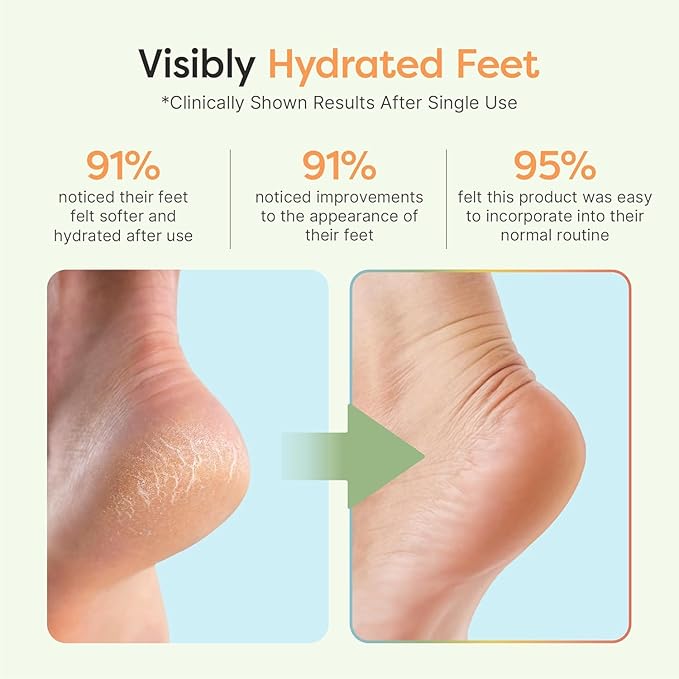 ZenToes Moisturizing Socks for Cracked Heel Treatment, Vitamin E, Olive Oil and Jojoba Oil Heel Socks, Stocking Stuffers for Women, Spa Self Care Gifts for Women (Cheetah, Regular)