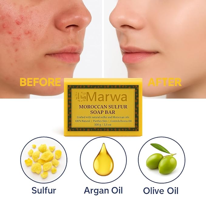 Moroccan Sulfur Soap Bar – Natural Handmade Cleanser for Clear, Balanced Skin & Blemish Control with Argan Oil and Shea Butter – Clarifying Face & Body Wash – 3.5 Oz