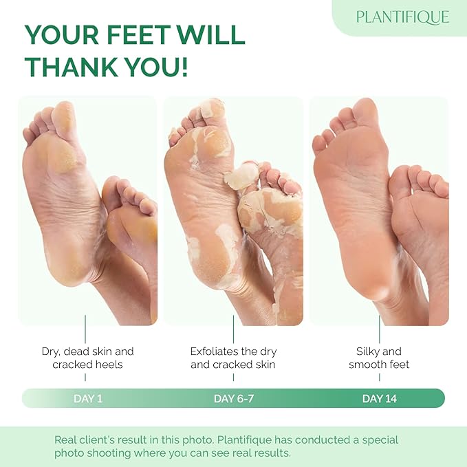 PLANTIFIQUE Foot Peeling Mask 4 Pack | Dermatologically Tested Repairs Heels & Removes Dry Dead Skin for Baby Soft Feet | Exfoliating Foot Peel Mask for Dry Cracked Feet | Peach