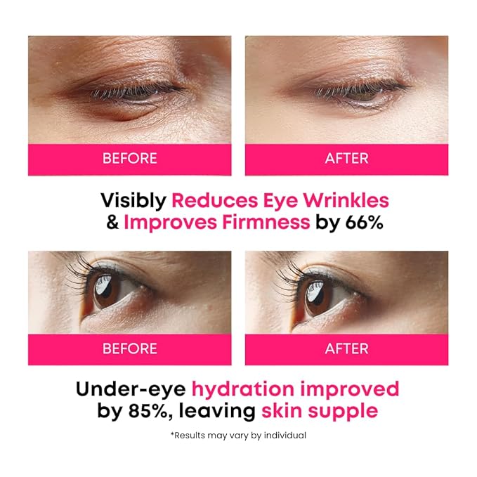 360° Collagen Eye Masks – Korean Under Eye Patches with Bakuchiol Retinol, Fine Lines & Wrinkle Care, Dark Circle Treatment, 50 Masks