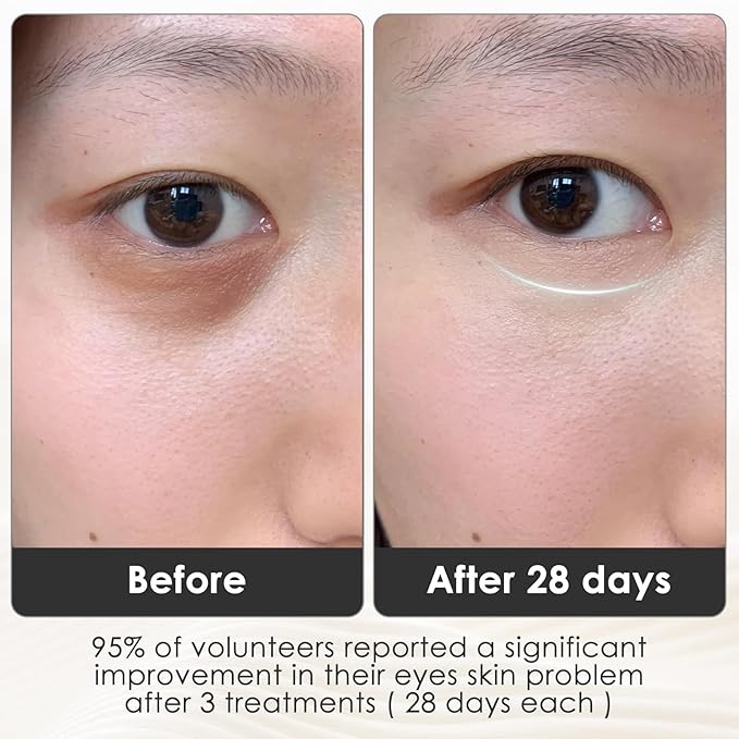 Red Infrared Light Therapy for Eyes, Under Eye 630nm + 850nm LED Light Therapy with 3 Modes, Rechargeable Skin Care Device Eye Recovery
