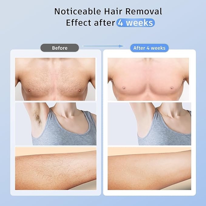 Laser Hair Removal Ubroo IPL Hair Removal Device with 5℃ Ice Cooling,Painless Laser Hair Removal for Women and Men,Full Body Use for Legs,Bikini,Armpits (Purple)