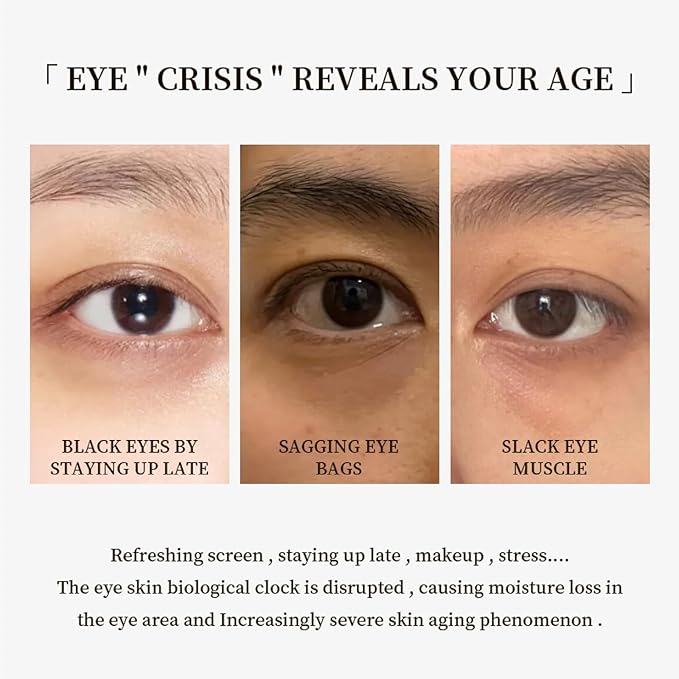 Eye Cream for Dark Circles and Puffiness - Anti Aging Eye Cream Enriched with VA VC VE, Firming & Hydrating Under Eye Treatment for Wrinkles, Eye Bags, Fine Lines, 30g/1oz