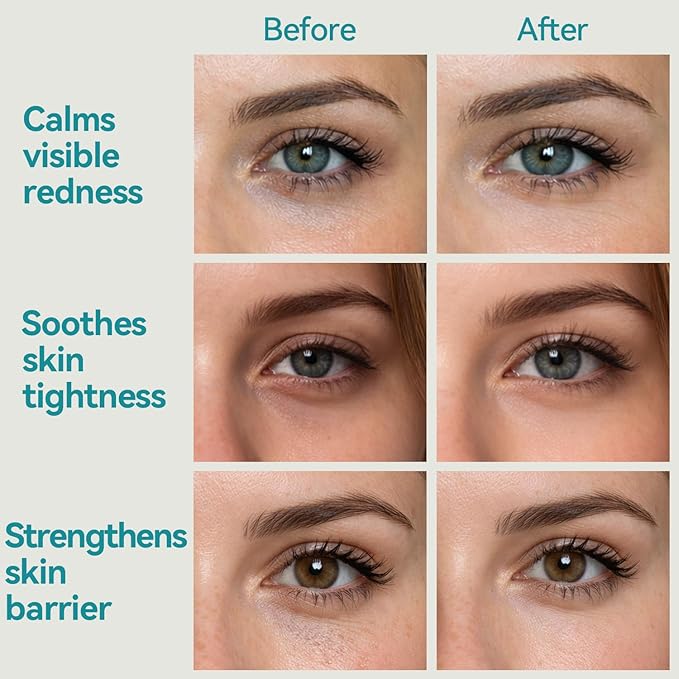 Shield Energy Soothing Under Eye Patches (28 Pairs), Vitamin B3, B5 & Ectoin Hydrogel Eye Mask for All Skin Types, including Sensitive Skin & Redness - Fragrance-Free, Barrier Repair, Deep Hydration
