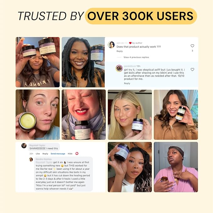 MyMagicHealer Universal Flare Care | Drawing Salve for HS, Boils, Cysts, Hemorrhoids, Pilonidal Cyst, Abscess | Anti-Chafing, Wound Care, Relief for Itching Skin w/Propolis & Egg Yolk Extract 1 oz