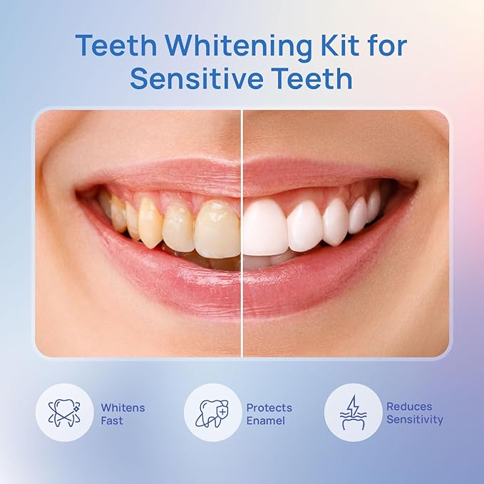 Whitebite Pro Vertical Dual LED Teeth Whitening Kit with Charging Dock – Professional at-Home Dental Whitening Machine with Pens, Tooth Stain Remover for Sensitive Teeth, Travel-Friendly Oral Hygiene