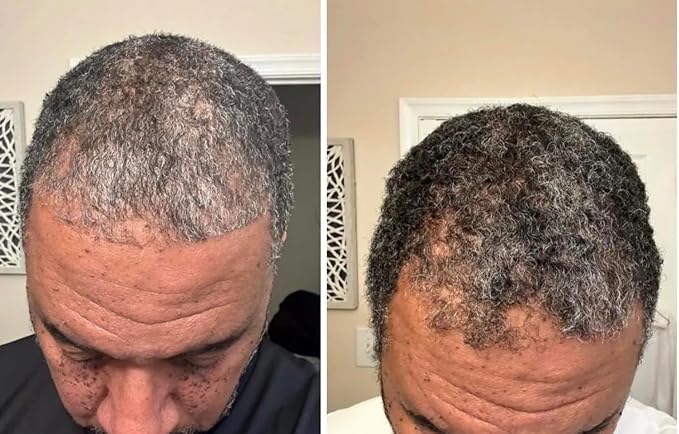 Hair Growth Oil with Rare Batana & Ayurvedic Herbs - Extra Strength Natural Treatment for Thinning Hair Loss, Edges, Scalp Health - Strengthens & Thickens All Hair Types - 30+ Botanicals - 2oz