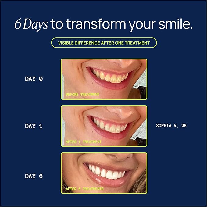 Laughland Original Teeth Whitening Gel 3 Pack, Tooth Whitener, Made with 8% Hydrogen Peroxide, Glycerin, Aloe Vera & Mint, at Home Dental Care, Travel Friendly, 6 Treatments (3 Pack, Original)